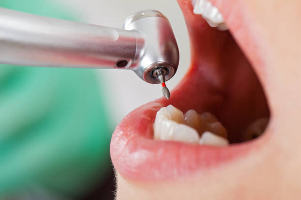 Best Walk-In Emergency Dental Services in Mona, UT